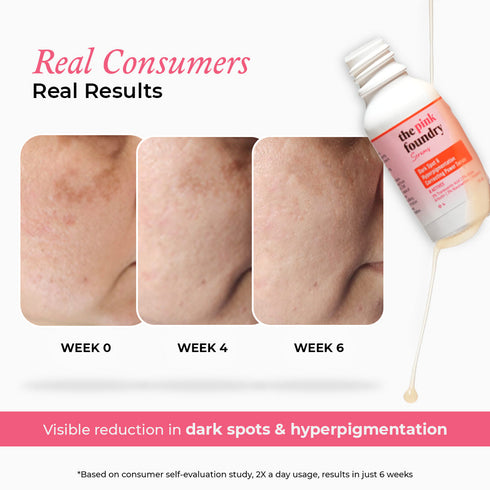 The Pink Foundry Dark Spot & Hyperpigmentation Correcting Power Serum