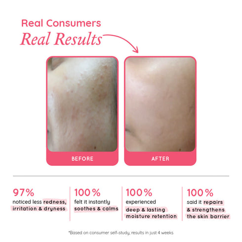The Pink Foundry Barrier Repair & Restore Moisturiser