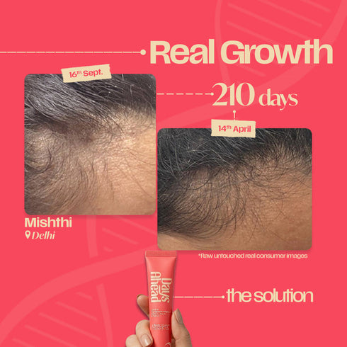 Days Ahead Leave-in Hair Growth Ampoule Serum (Roll on)
