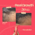 Days Ahead Leave-in Hair Growth Ampoule Serum (Roll on)