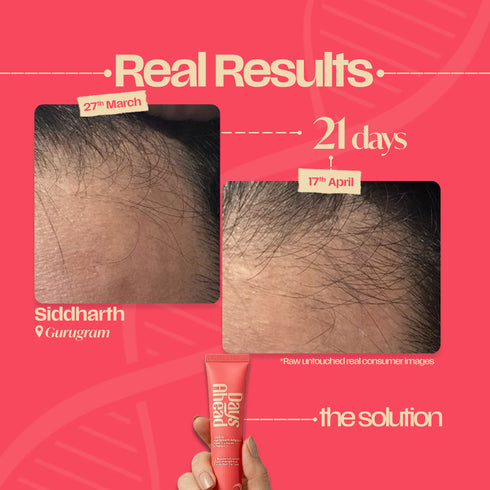 Days Ahead Hairfall Reset Routine