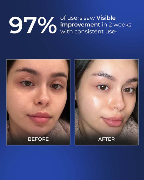 Aqueria Brightening French Serum for Glow Dark Spots & Pigmentation