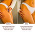 Namyaa Skincare Body Butter for Stretch Marks & Scars
