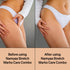 Namyaa Skincare Stretch Marks Care Combo