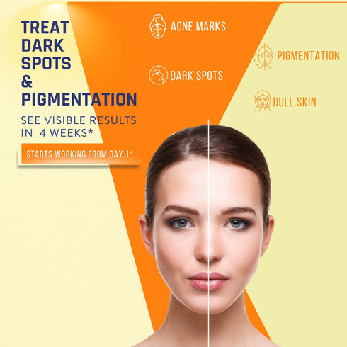 Skin Deli Radiant Beams