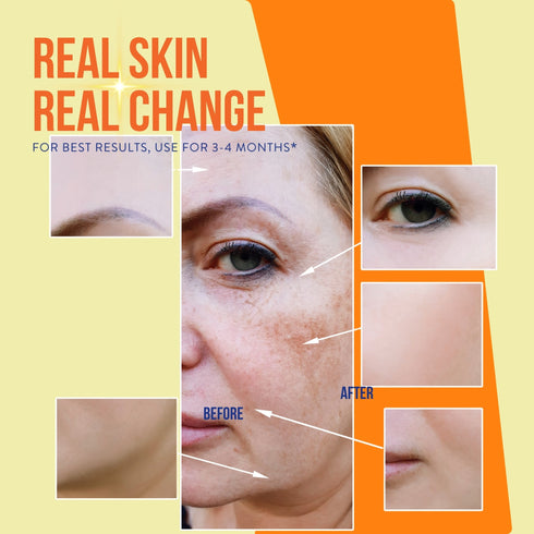 Skin Deli Radiant Beams
