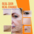 Skin Deli Radiant Beams