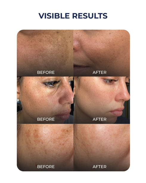 Aqueria Multi Active Discovery Kit for Brightening Dark Spots and Even Skin Tone