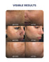 Aqueria Multi Active Discovery Kit for Brightening Dark Spots and Even Skin Tone