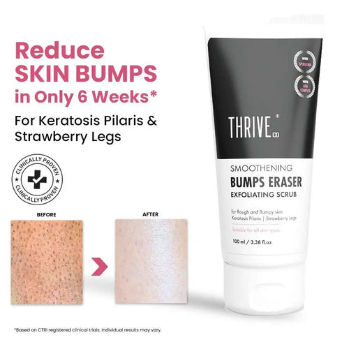 Thriveco Smoothening Bumps Eraser Exfoliating Scrub