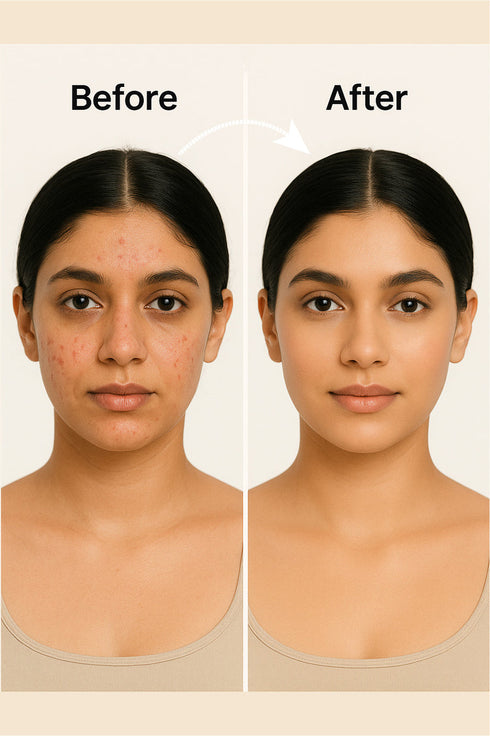 The wellness shop BYE BYE ACNE
