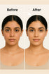 The wellness shop BYE BYE ACNE