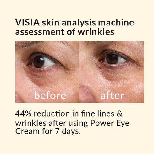 Avon Anew Skin Renewal Power Eye Cream