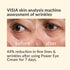 Avon Anew Skin Renewal Power Eye Cream