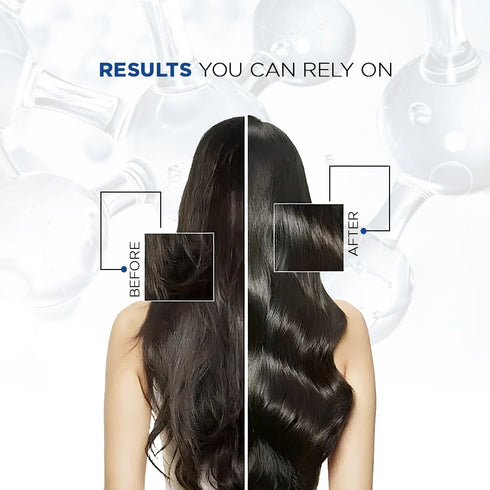 Trigaine caffeine shampoo for hair fall control