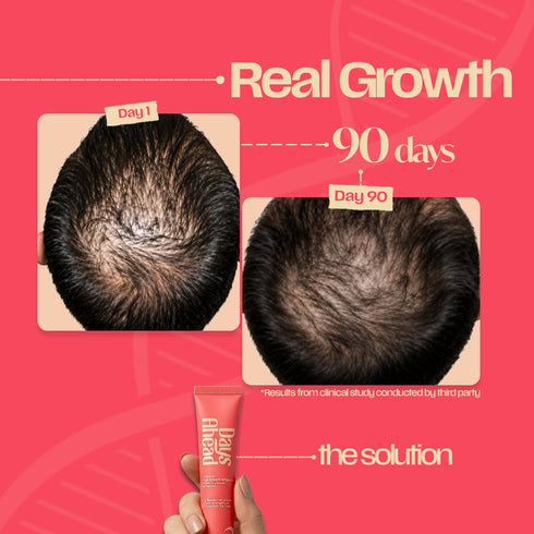 Days Ahead Leave-in Hair Growth Ampoule Serum (Roll on)