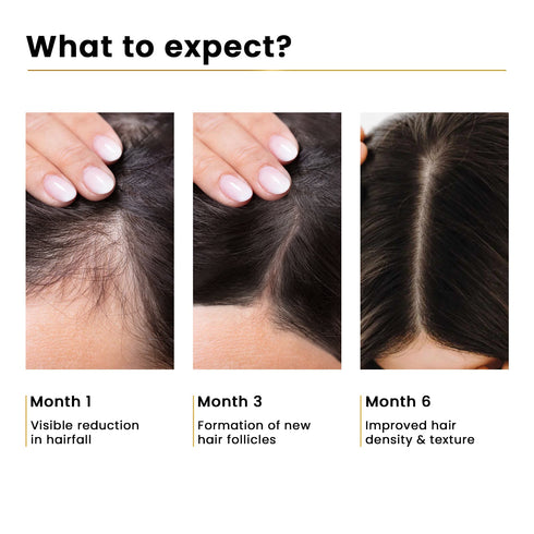 The Skin Story Advanced Hair Growth Serum