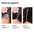 The Skin Story Advanced Hair Growth Serum