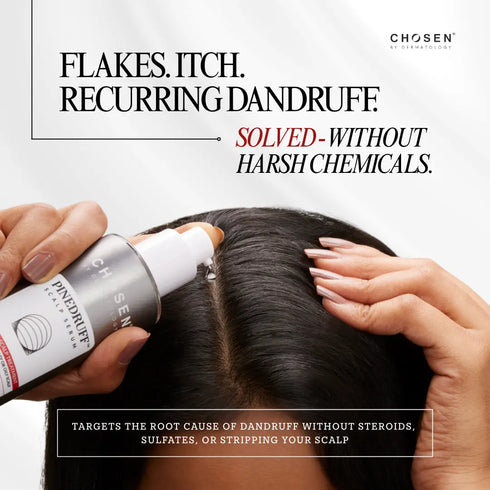 Chosen Pinedruff Scalp Serum