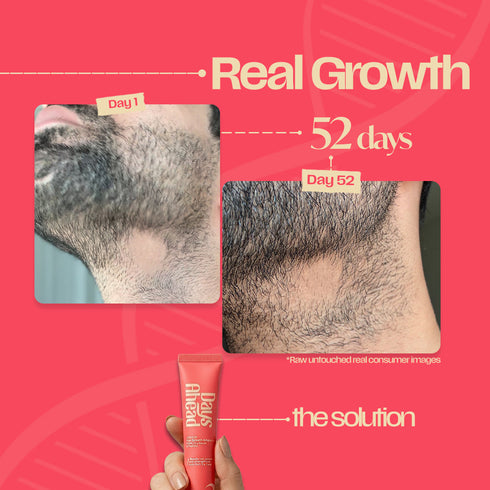Days Ahead Leave-in Hair Growth Ampoule Serum (Roll on)
