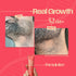 Days Ahead Leave-in Hair Growth Ampoule Serum (Roll on)