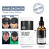 Thriveco Hair Growth Serum 2 0 For Men & Women