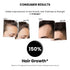Thriveco Hair Growth Serum 2 0 Spray For Men & Women