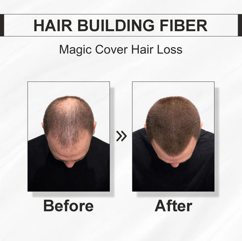 Shills Professional Hair Building Fiber Black Powder 25g