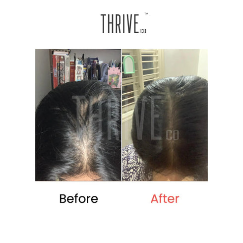 Thriveco Hair Growth Serum Scalp Exfoliating Scrub