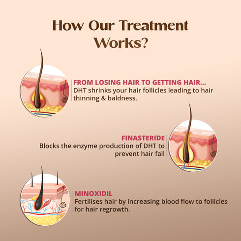 Healing Pharma Minoxytop F 5% Minoxidil Finasteride Hair Regrowth Solution