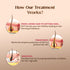 Healing Pharma Minoxytop F 5% Minoxidil Finasteride Hair Regrowth Solution