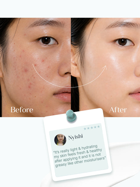 SEOULSKIN Salicylic Acid Oil-Free Face Moisturiser