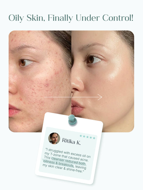 Seoulskin Salicylic Acid Acne-Control Face Wash