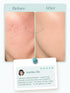 SEOULSKIN Salicylic Acid Acne Control Face Serum