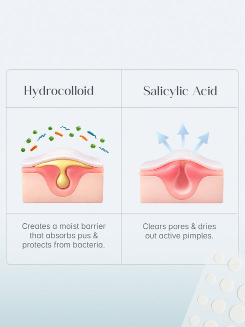 Seoulskin Acne Pimple Patch