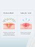 Seoulskin Acne Pimple Patch