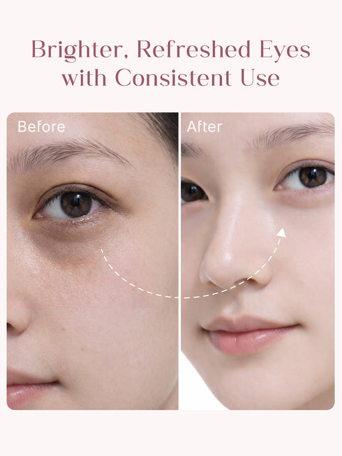 Seoulskin Under Eye Cream