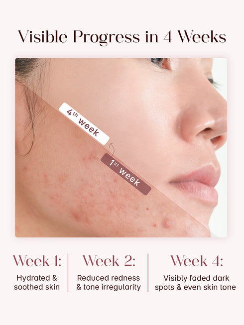 Seoulskin Red Serum