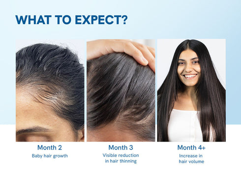 Bodywise advanced Hair Growth Serum Roll On