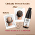 Healing Pharma Minoxytop F 5% Minoxidil Finasteride Hair Regrowth Solution