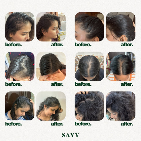 SAYY Scalp Revival Monthly Pack