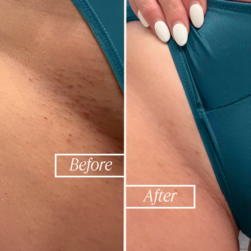Namyaa Skincare Intimate Glow Combo