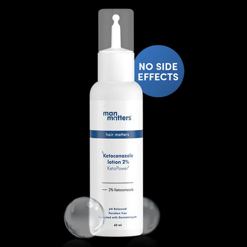 Man Matters ketoconazole lotion