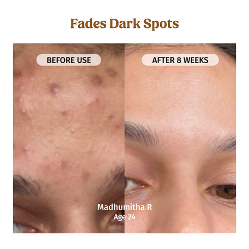 V-ilvah Store Milk Drops Brightening Serum