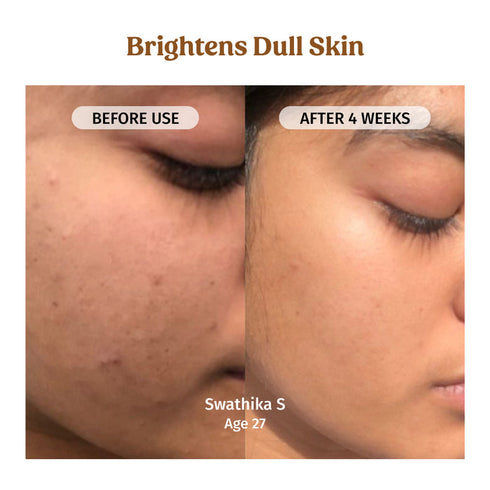 V-ilvah Store Milk Drops Brightening Serum