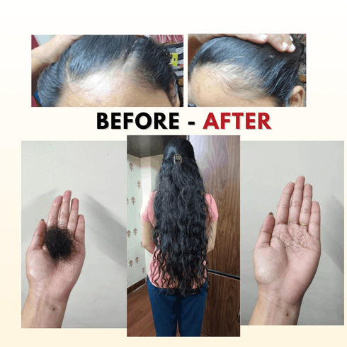 Tvishi Skincare Hair Repair Bundle