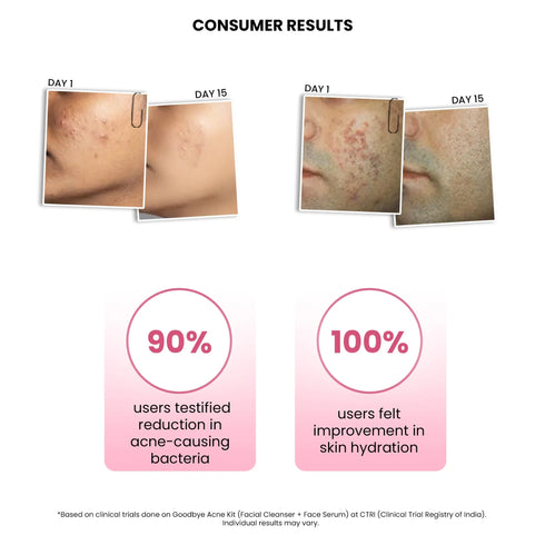 Thriveco Goodbye Acne Facial Cleanser