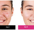 Thriveco 2 Salicylic acid Serum