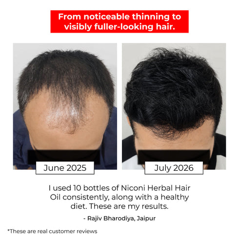 Niconi Herbal Hair Oil (Comb Applicator) 200ml