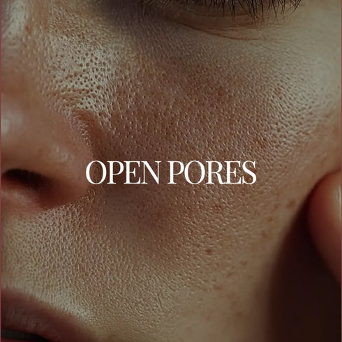 Natuur Regimen For Open Pores